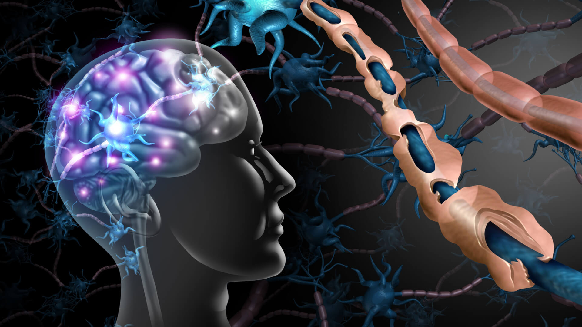 Autoimmune Disease