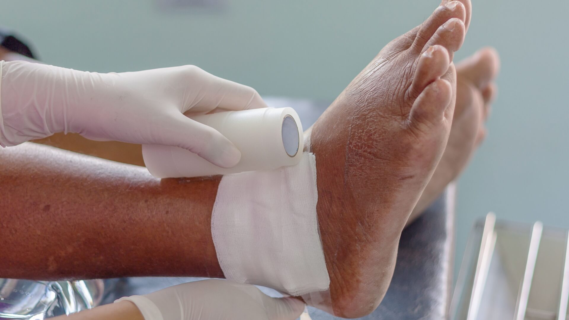 Chronic Wound Care